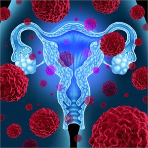 New study provides ideas to prevent Ovarian Cancer Spread