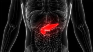 Pulling the plug on pancreatic cancer cells