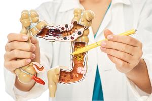 Colorectal polyps turn cancerous with certain bacteria present