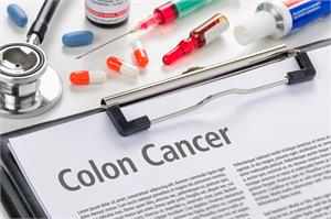 * Colorectal Cancer - Latest News, Latest Research | CANCERactive
