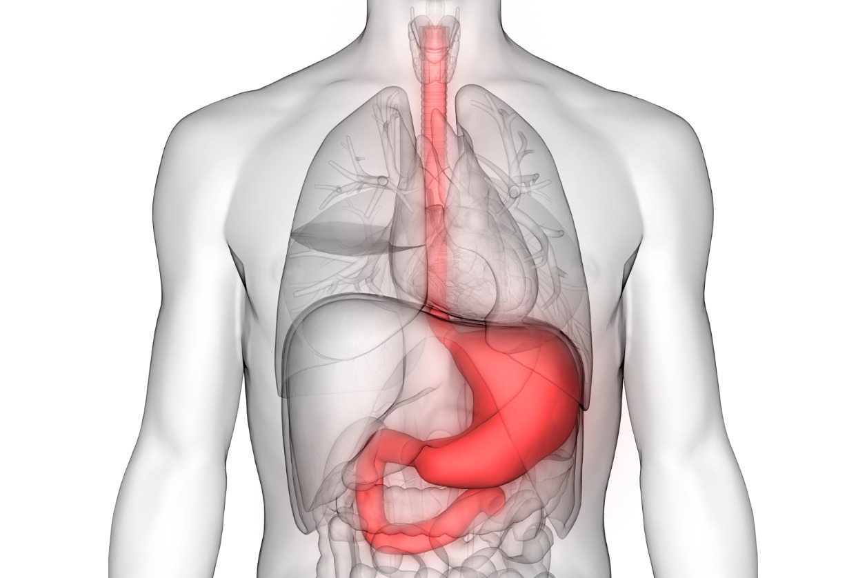 * An Overview of Stomach or gastric Cancer - symptoms, treatments and therapies
