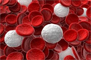 * An Overview of Leukemia cancer - symptoms, causes and alternative treatments