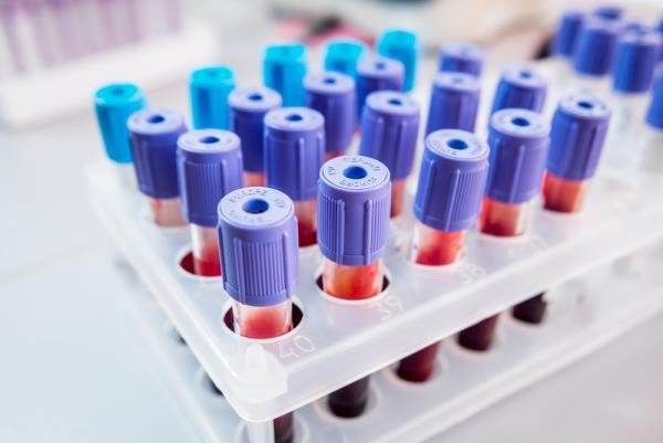 New Blood test detects cancer cells years before metastases