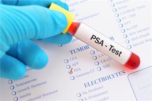 Stanford Professor dubs PSA test - almost useless