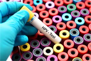 More accurate test for HPV launched